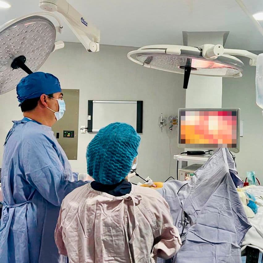 Todo lo que debes saber sobre la cirugía de vesícula